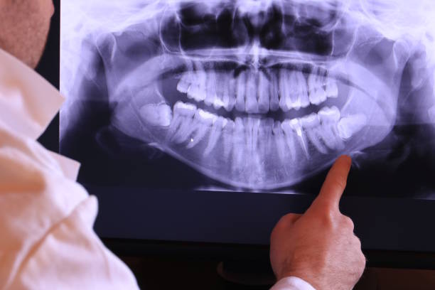 Best Dentist for Tooth Abscess  in Sugar Grove, IL